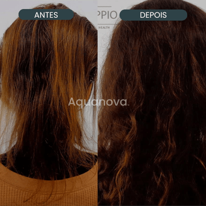 Sistema Micro Infusão  - Aquanova [Tratamento Completo]